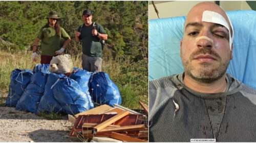 &quot;Τι ομάδα είσαι;&quot;, &quot;είσαι αναρχικός;&quot; - Νέα στοιχεία για την άγρια επίθεση σε εθελοντές στην Πάρνηθα