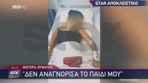 Χαλκίδα: Ξυλοκόπησε άγρια την 19χρονη σύντροφό του και κυκλοφορεί ελεύθερος – &quot;Εφτυνα αίμα από τις μπουνιές&quot;