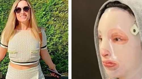 Επίθεση με βιτριόλι: Η συγκλονιστική εξομολόγηση της Ιωάννας - Τι ζητά ένα χρόνο μετά