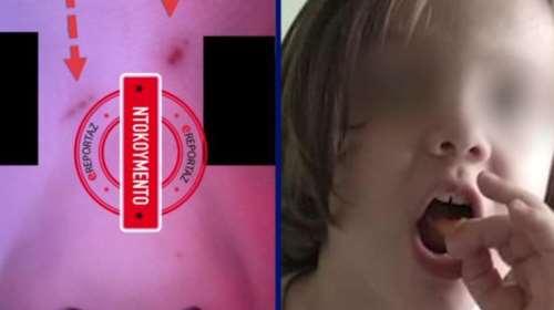 Πάτρα: Τα σημάδια στο πρόσωπο της Μαλένας δείχνουν δολοφονία - Προθανάτιες οι νυχιές στα μάγουλα [Βίντεο]