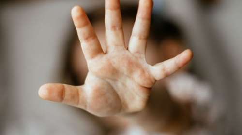 Καταγγελία 13χρονης: Τη βίασε ο 47χρονος θείος φίλης της - Δεν συνελήφθη ο δράστης