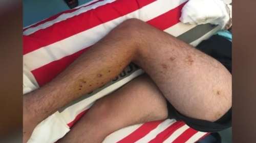 Αλεποχώρι: Σοκάρουν οι εικόνες από τα τραύματα του 14χρονου που πυροβόλησε ο 70χρονος [Βίντεο]