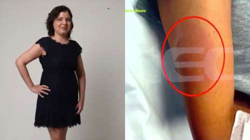 Μαρίσσα Λαιμού: Αυτή είναι η επίσημη διάγνωση του UCLH - Το πρησμένο χέρι και το &quot;δάγκωμα&quot; που εντόπισαν