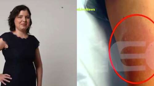 Μαρίσσα Λαιμού: Από σήψη προήλθε ο θάνατός της, σύμφωνα με Βρετανό ιατροδικαστή - Το σενάριο για στρεπτόκοκκο Β&#39; [βίντεο]