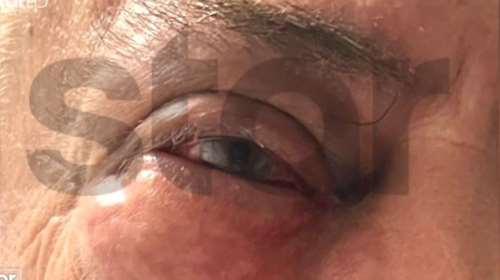 Γλυφάδα: Οικονομικές διαφορές 6 εκατ. ευρώ είχε ο επιχειρηματίας που κατήγγειλε ξυλοδαρμό από τον Ισραηλινό πρώην συνέταιρό του