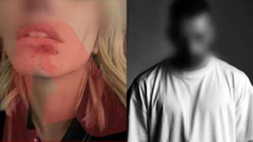 Ξυλοδαρμός μοντέλου από Dj: &quot;Θα σας σκοτώσω με τα ίδια μου τα χέρια&quot; - Οι απειλές του 40χρονου στην πρώην σύντροφό του