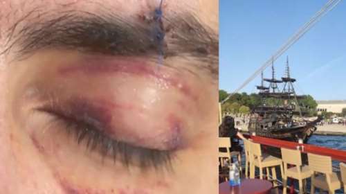 Θεσσαλονίκη: Νταής ξυλοκόπησε άγρια 45χρονο καθηγητή σε πλωτό μπαρ- &quot;Είχα ζητήσει ξηρούς καρπούς δύο φορές και μου ζήτησε τον λόγο&quot;