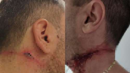 Θεσσαλονίκη: &quot;Μας ράντισε με ούρα και μας έκοψε με τζάμι&quot; - Τι λένε οι αστυνομικοί για την επίθεση από 45χρονο