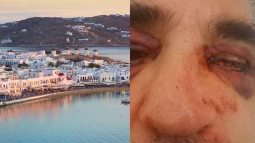 Μύκονος: Στα ίχνη των δραστών της μαφιόζικης επίθεσης στον αρχαιολόγο βρίσκεται η Αστυνομία [Βίντεο]