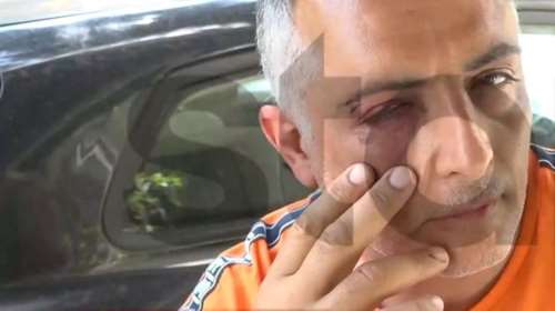 Σοκ για ελεγκτή εισιτηρίων στην Αμφιθέας - Τρία άτομα τον ξυλοκόπησαν και τον δάγκωσαν