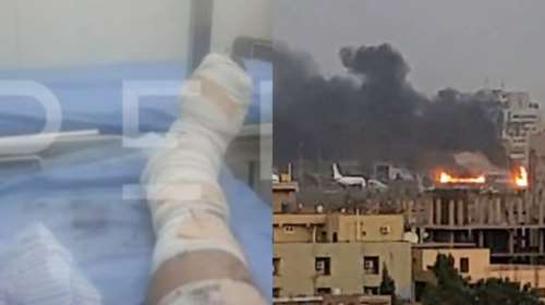 Σουδάν: Φωτογραφία ντοκουμέντο του Έλληνα τραυματία μέσα από το νοσοκομείο - Δεν υπάρχουν γιατροί