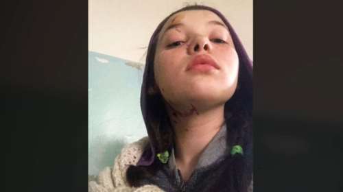 Συγκλονίζει η 12χρονη από τη Μαριούπολη: Πώς γλίτωσε από τους Ρώσους και το ορφανοτροφείο μετά τον φόνο του πατέρα της