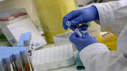 Κορονοϊός: 19.509 νέα κρούσματα - 82 θάνατοι και 485 διασωληνωμένοι