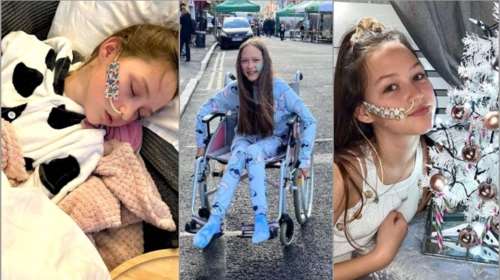 &quot;Δεν μπορεί να φάει, να κοιμηθεί και δυσκολεύεται να περπατήσει&quot; - Ο εφιάλτης του Long Covid για 12χρονο κορίτσι