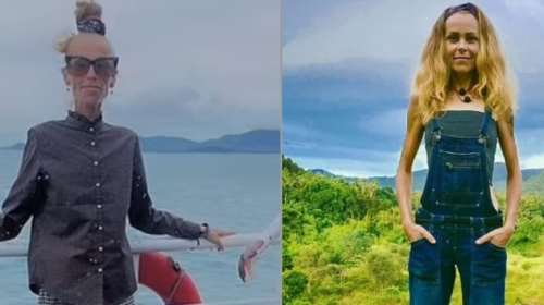 Στοιχεία σοκ για τη Ρωσίδα influencer που πέθανε από ασιτία - Έτρωγε μόνο δύο φρούτα και δεν έπινε νερό