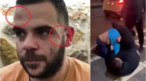 Γνωστός YouTuber δέχεται άγρια επίθεση σε live στα Ιωάννινα - Προσοχή σκληρές εικόνες