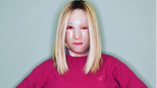 Το δέκατο χειρουργείο για την Ιωάννα Παλιοσπύρου: Η φωτογραφία χωρίς μάσκα με τις γάζες στο κρεβάτι