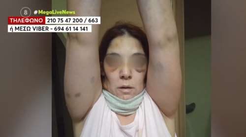 Άργος: &quot;Έτρωγα ξύλο για πέντε χρόνια, μου έλεγε ότι θα με σκοτώσει&quot; – Συγκλονίζει η 32χρονη που την κακοποιούσε ο σύζυγός της