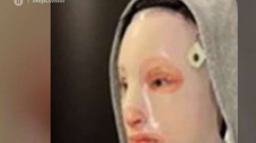 Επίθεση με βιτριόλι: Τι είναι η ειδική μάσκα και γιατί τη φορά σχεδόν όλη τη μέρα η Ιωάννα [Βίντεο]