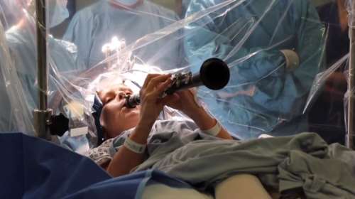 Βρετανία: Ασθενής με νόσο Πάρκινσον παίζει κλαρινέτο την ώρα που υποβάλλεται σε χειρουργείο στον εγκέφαλο [βίντεο]