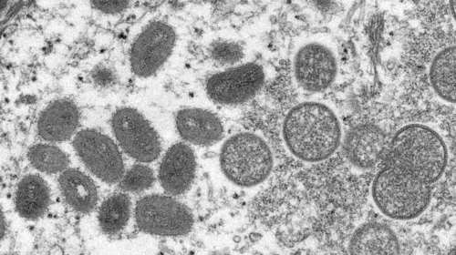 Λινού: Απίθανο να μην εμφανιστεί και στην Ελλάδα η ευλογιά των πιθήκων - Ο κόσμος να μην ανησυχεί, αλλά να προσέχει