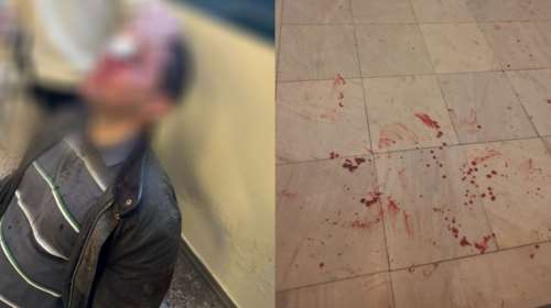 Επεισόδια στη Νομική Αθηνών: &quot;Τελειώσατε τώρα&quot; φώναζαν οι κουκουλοφόροι - &quot;Δεν έχω δει ξανά τόση βία στο πανεπιστήμιο&quot; [εικόνες - βίντεο]