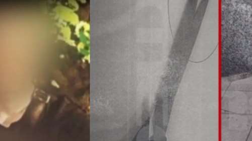 Νέα Σμύρνη: Γνωστός στιχουργός ο πατέρας των αδερφών - &quot;Ατύχημα έγινε - Τα παιδιά μου είχαν μπλέξει με κακές παρέες&quot; [Βίντεο]