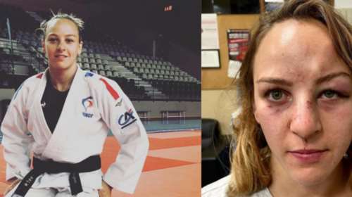 Σοκ στη Γαλλία: Αγριος ξυλοδαρμός της Ολυμπιονίκη του τζούντο, Margaux Pinot από τον σύντροφο και προπονητή της
