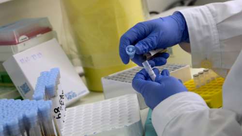 Κορονοϊός - Πρωτοπορία: Αυστραλοί ερευνητές επινόησαν διαγνωστικό τεστ αίματος που δίνει αποτέλεσμα σε 20 λεπτά