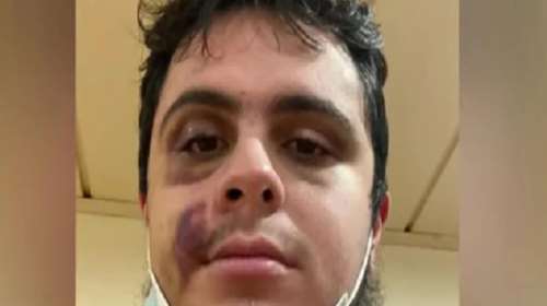 Νέα καταγγελία για οπαδική βία: Χτύπησαν άγρια 23χρονο στη μέση του δρόμου - &#39;&#39;Αυτό που με χωρίζει από τον Άλκη, είναι η τύχη&#39;&#39;