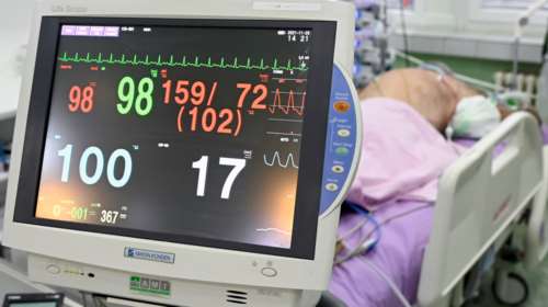 Κορονοϊός: &quot;Εκτόξευση&quot; με 7.486 νέα κρούσματα - 88 θάνατοι και 664 διασωληνωμένοι