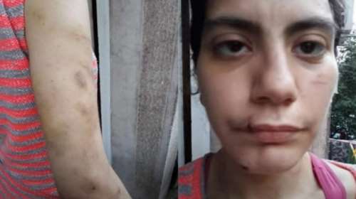 Γειτόνισσα Φαίης Μπακογιώργου: Τελευταία φορά την είδα με αίματα και σημάδια - Δεν μπορούσε να μιλήσει