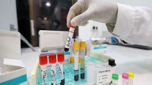 Επαναστατικό τεστ αίματος ανιχνεύει τον καρκίνο σε ανθρώπους που δεν έχουν συγκεκριμένα συμπτώματα