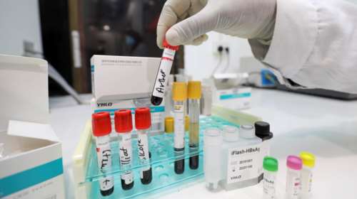 Κορονοϊός: Ανακαλύφθηκε πρωτεΐνη που μπλοκάρει τη λοίμωξη - Κολλά σαν... αυτοκόλλητη ταινία στον ιό