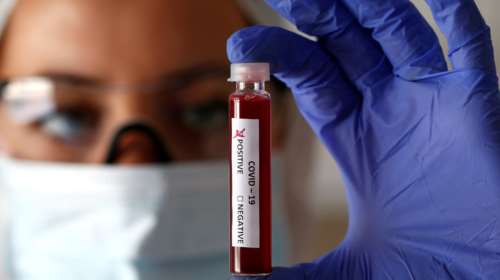 Συναγερμός στα Τρίκαλα: Θετική στον κορονοϊό 15χρονη μαθήτρια - Έκλεισε το τμήμα της