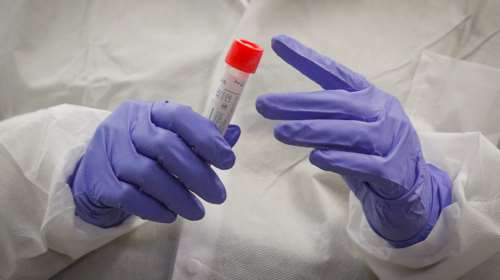 Αποκαλυπτική μελέτη: Ο κορονοϊός δεν φαίνεται να μεταδίδεται μέσω του ανδρικού σπέρματος