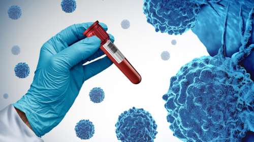 Καρκίνος: Ξένοι ερευνητές με επικεφαλής Έλληνα καθηγητή ανέπτυξαν καινοτόμο μέθοδο για διάγνωση και θεραπεία