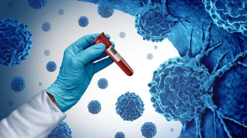 Το 40% των περιπτώσεων καρκίνου οφείλεται σε τροποποιήσιμους παράγοντες κινδύνου