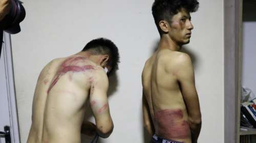 Αφγανιστάν: Ταλιμπάν βασάνισαν δύο δημοσιογράφους παρά τις υποσχέσεις για μη βία