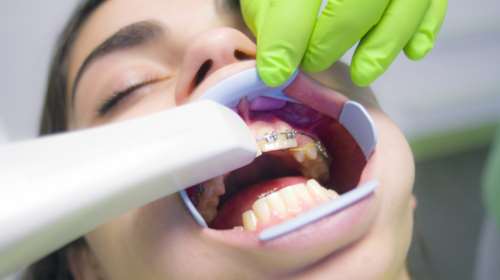 Dentist Pass: Παρατείνεται η προθεσμία υποβολής αιτήσεων έως τις 22 Δεκεμβρίου