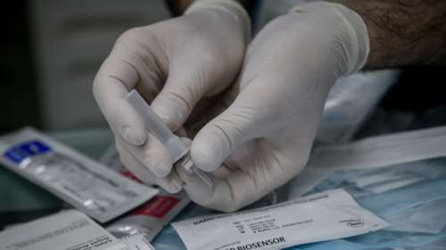 Γεωργιάδης για self test: Οι ειδικοί θέλουν δύο την εβδομάδα, αλλά στα πρακτικά της επιτροπής αναφέρεται &quot;σύσταση&quot; για δεύτερο