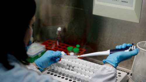 Ευλογιά των πιθήκων: Οι τρόποι μετάδοσης και τα συμπτώματα - Σε ετοιμότητα το Ινστιτούτο Παστέρ