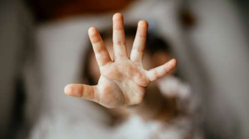 Βόλος - Σοκαριστική καταγγελία: Προσπάθησαν να αρπάξουν 20 μηνών μωρό