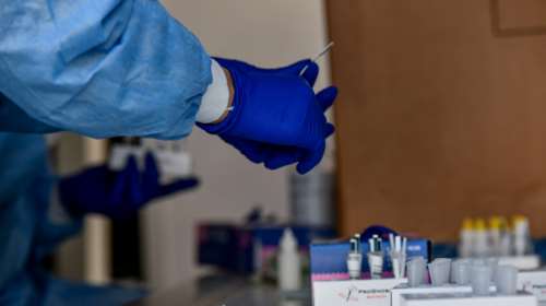 Κορονοϊός: Μείωση της θετικότητας, αλλά αύξηση στις εισαγωγές - 28 θάνατοι, στους 20 οι διασωληνωμένοι