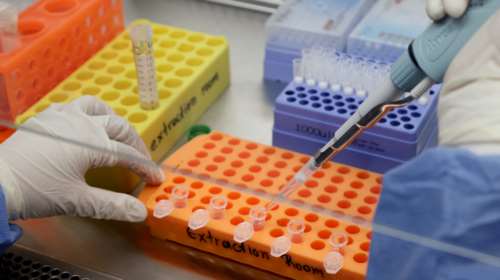 Κορονοϊός: Η θεραπευτική μελέτη με πλάσμα αίματος από Έλληνες γιατρούς που δίνει ελπίδες [βίντεο]