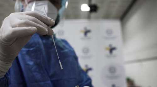 Έκκληση Γκάγκα: Μην πάτε για PCR μετά το θετικό rapid τεστ, μείνετε σπίτι - Πάνω από το 60% των κρουσμάτων είναι Όμικρον