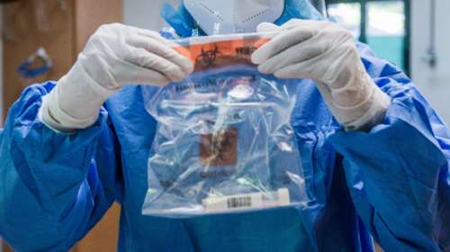 Κορονοϊός: Αυτό είναι το πρώτο ελληνικό rapid test – Ποιοι το υλοποίησαν