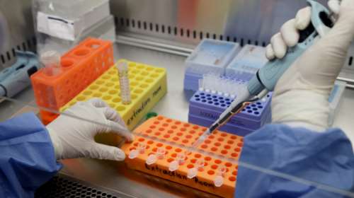 Κορονοϊός: Γιατί τα σημερινά μοριακά τεστ δεν είναι 100% ακριβή