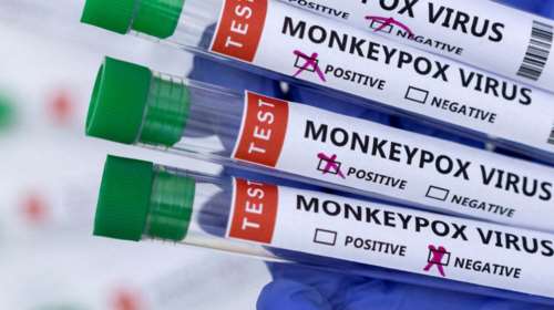 Έρχονται PCR τεστ και για την ευλογιά των πιθήκων: Οι οδηγίες των ειδικών και οι τρόποι μετάδοσης