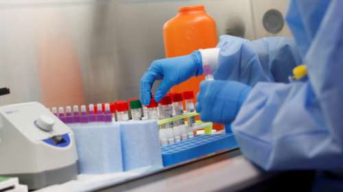 Κορονοϊός: Στο σπέρμα η απάντηση για πιθανές βλάβες στους απογόνους